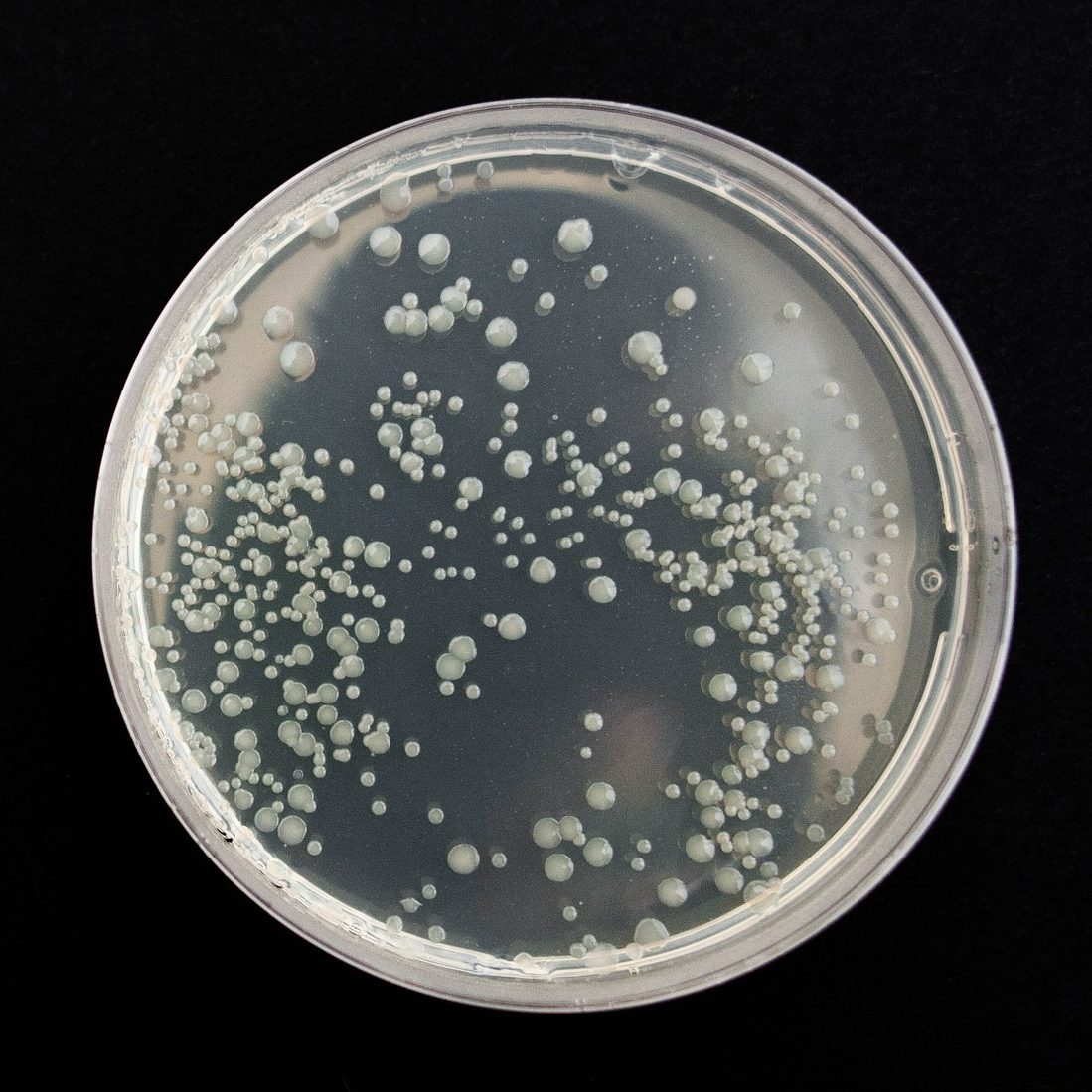 Bacteria growing on petridish.